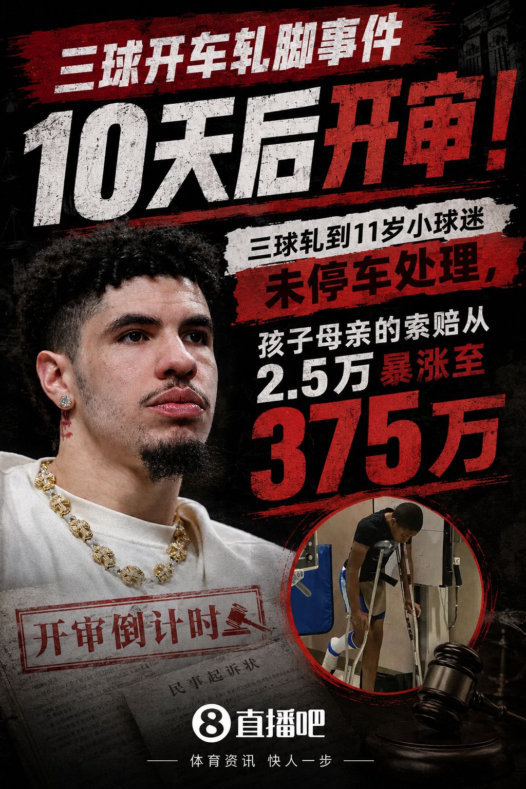 十天后开审！三球开车轧儿童小脚致骨折 索赔2.5万暴涨至375万  第1张
