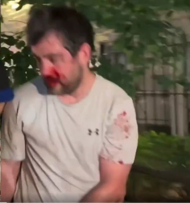 被打到退出刺籍！“邓肯”惨遭纽约暴徒围殴！血流满面脱球衣保命  第3张
