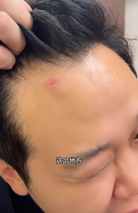 两名中国球迷在墨西哥城机场附近遭持枪抢劫 护照被抢报警后警方索要1万比索  第2张