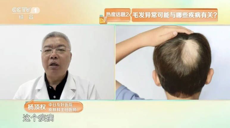 白发位置反映脏腑健康 前额对应脾胃 两鬓对应肝胆 头顶对应肾脏  第8张