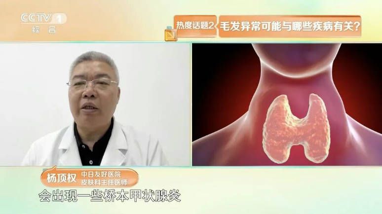 白发位置反映脏腑健康 前额对应脾胃 两鬓对应肝胆 头顶对应肾脏  第9张