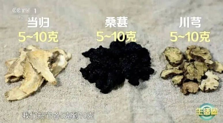 白发位置反映脏腑健康 前额对应脾胃 两鬓对应肝胆 头顶对应肾脏  第5张
