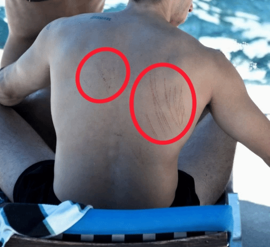 杜阿·利帕与卡勒姆·特纳蜜月影像流出，男方背部出现抓痕  第3张