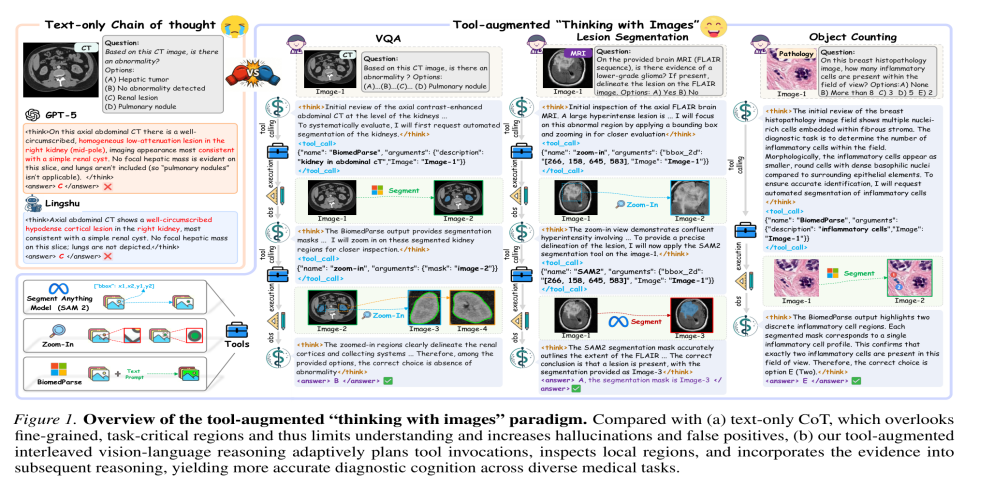 上海创智学院联合多所高校发表两篇ICML 2026论文，提出医学AI“Think with Images/Videos”范式  第3张