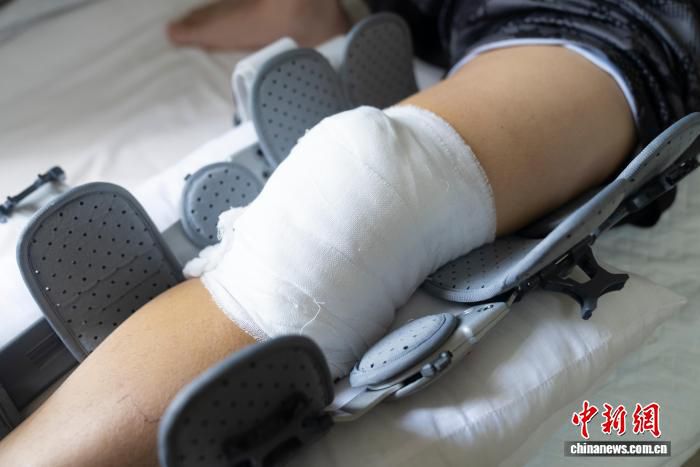 边境缉毒警回应儿子追问腿上伤痕：自己画上去的