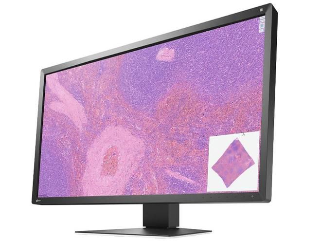 艺卓发布首款数字病理图像显示器PX3150,配备30.5英寸DCI 4K面板 第2张 艺卓发布首款数字病理图像显示器PX3150,配备30.5英寸DCI 4K面板 第2张